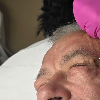Karboksyterapia