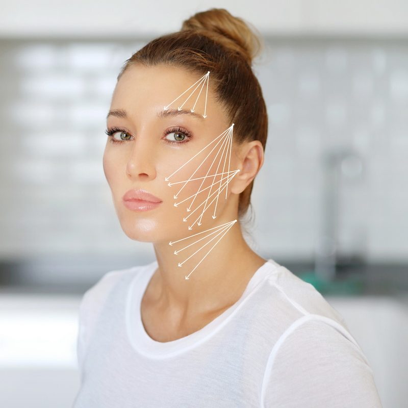 thread lift , nonsurgical procedure,lower facelift